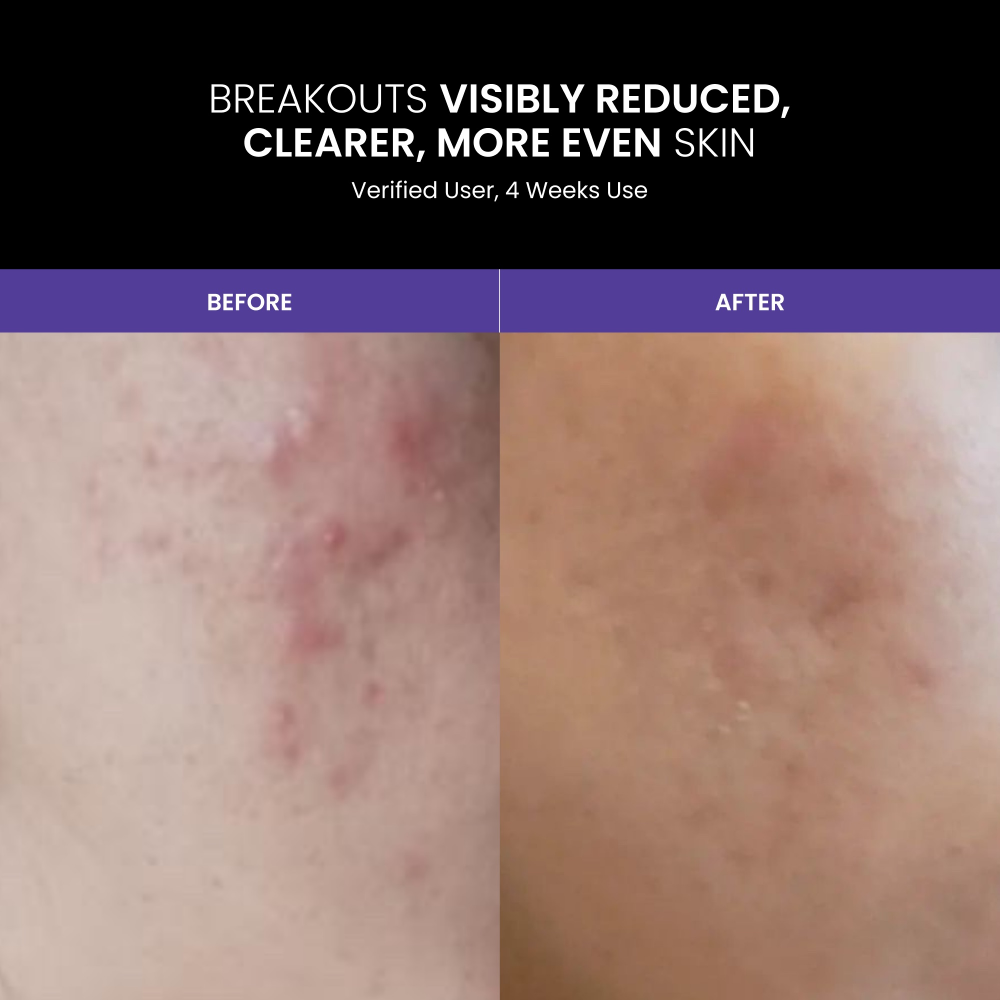 Lustre Revive Anti-Ageing LED Light Therapy Face Mask