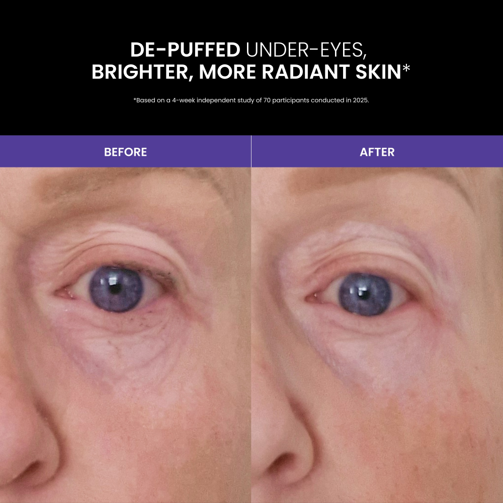 Lustre GoGlow LED Advanced Under Eye Patches