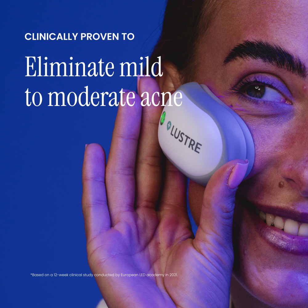 Lustre Solo LED Light Therapy Acne Pod