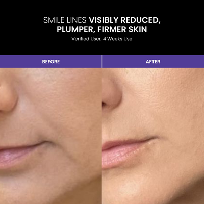 Lustre Revive Anti-Ageing LED Light Therapy Face Mask