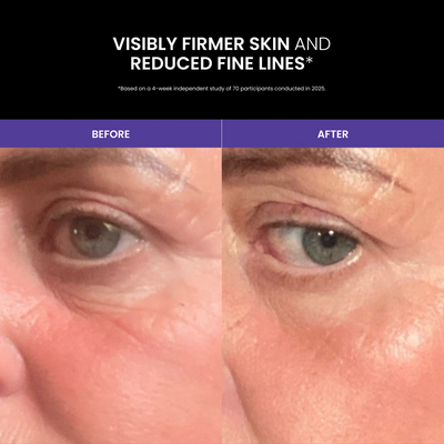 Lustre GoGlow LED Advanced Under Eye Patches